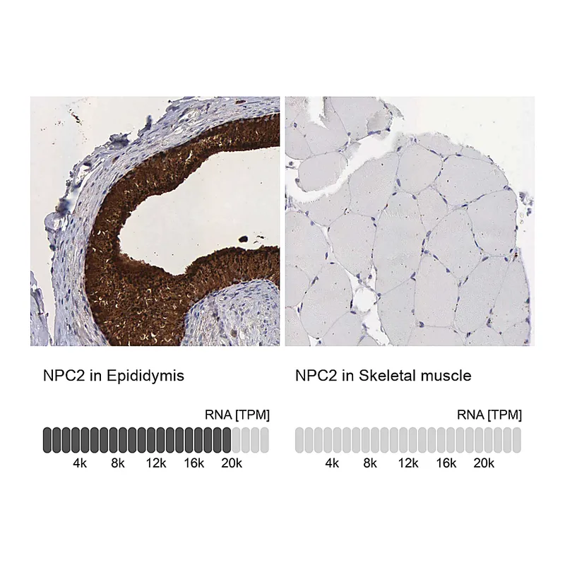 Atlas Antibodies Anti-NPC2 Antibody