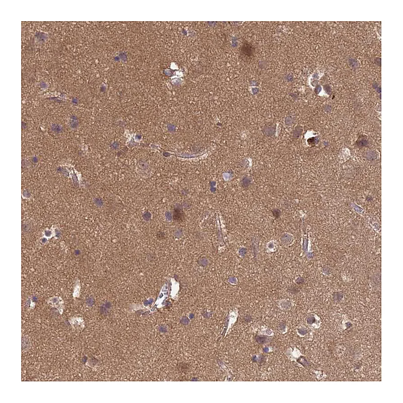 Atlas Antibodies Anti-NPEPPS Antibody