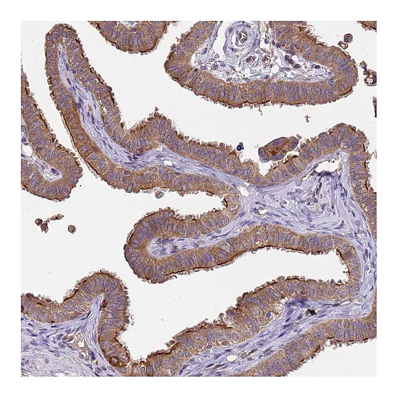 Atlas Antibodies Anti-NPHP1 Antibody