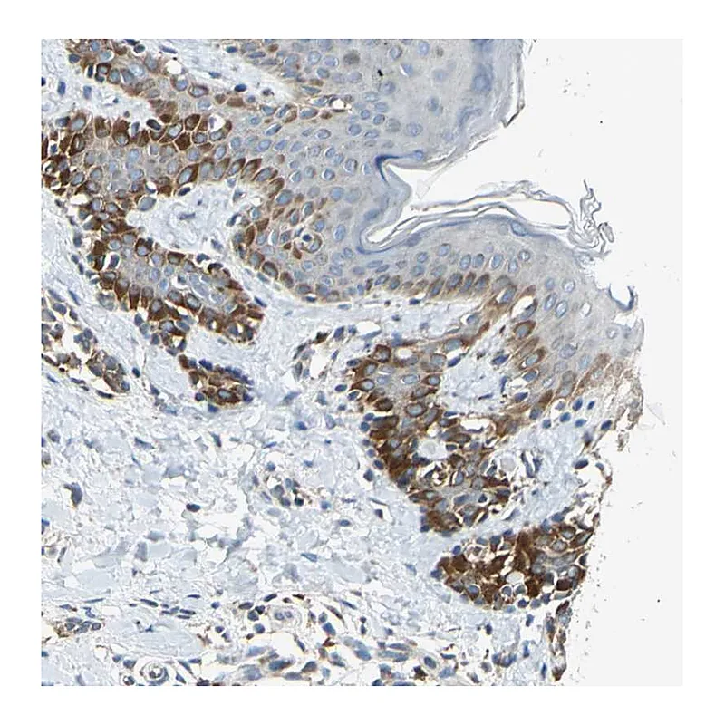 Atlas Antibodies Anti-NPHP3 Antibody