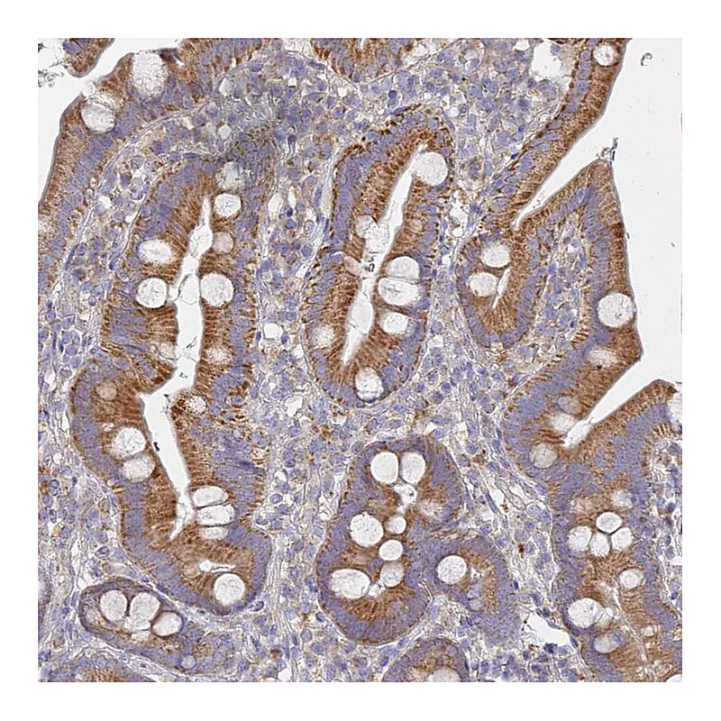 Atlas Antibodies Anti-NPEPPS Antibody