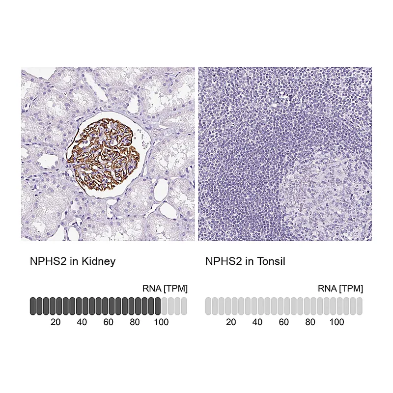 Atlas Antibodies Anti-NPHS2 Antibody