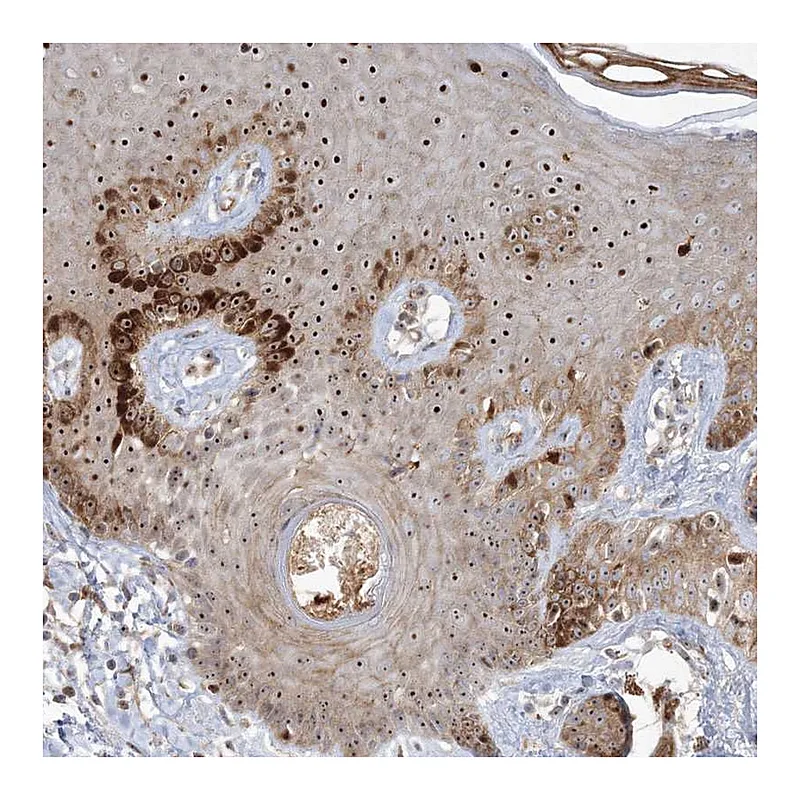 Atlas Antibodies Anti-NPM3 Antibody