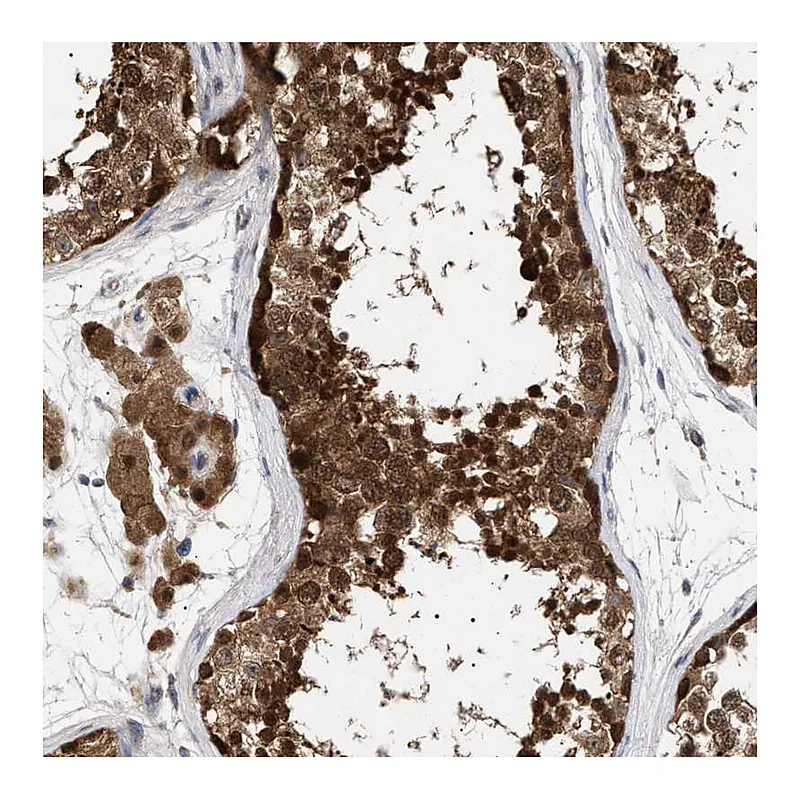 Atlas Antibodies Anti-NPLOC4 Antibody