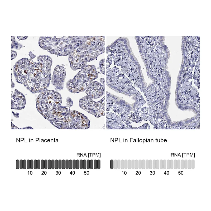 Atlas Antibodies Anti-NPL Antibody