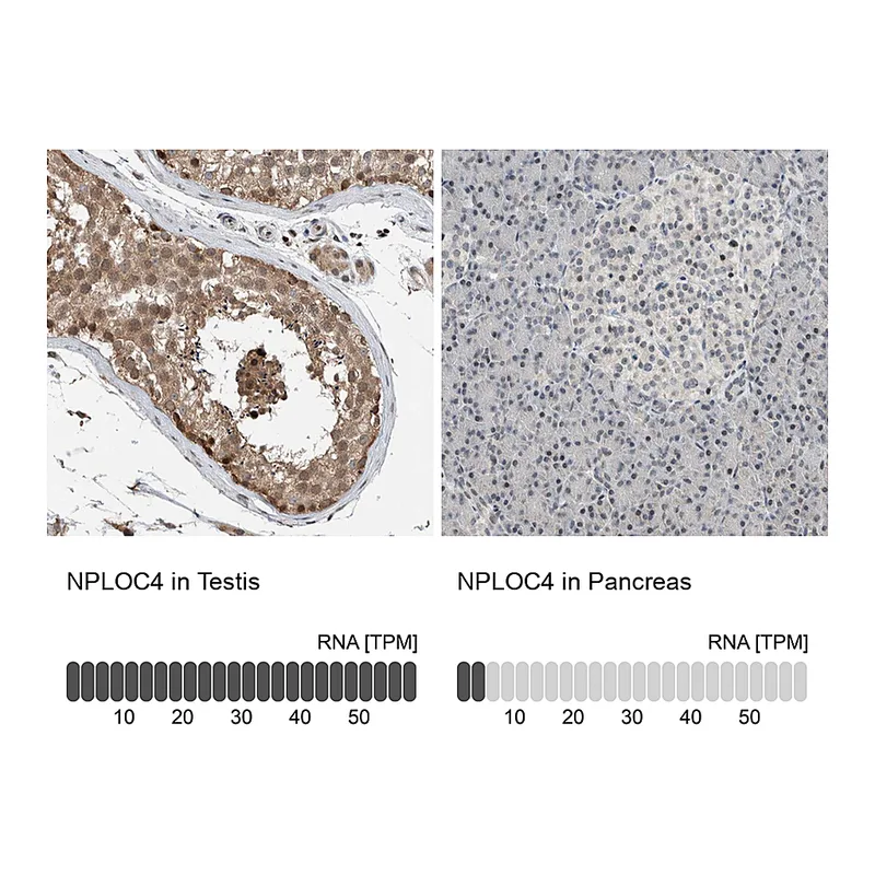 Atlas Antibodies Anti-NPLOC4 Antibody
