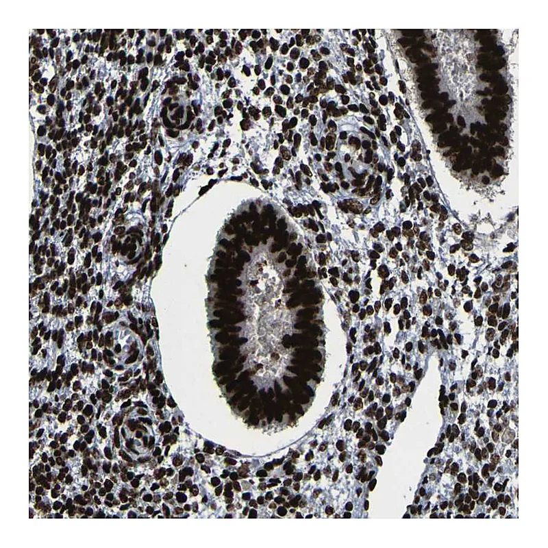 Atlas Antibodies Anti-NPM1 Antibody