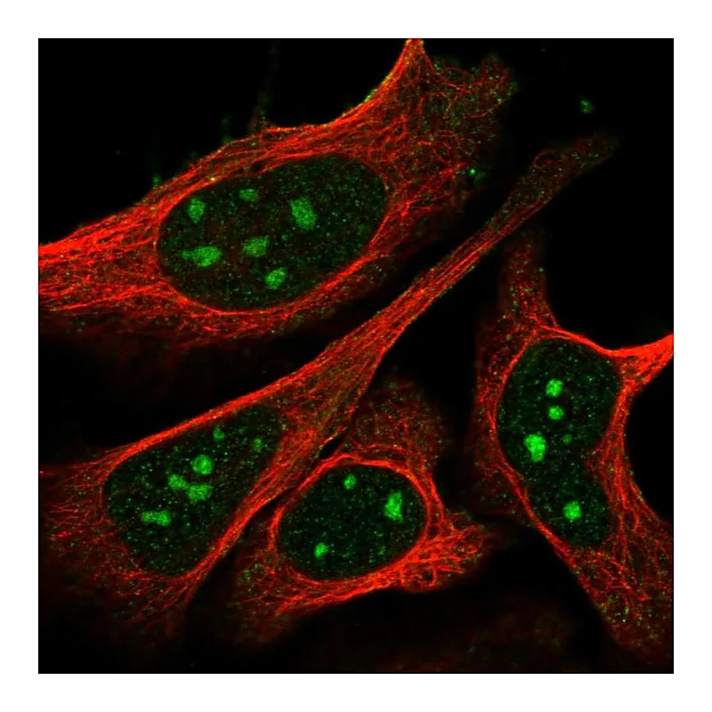 Atlas Antibodies Anti-NPR1 Antibody
