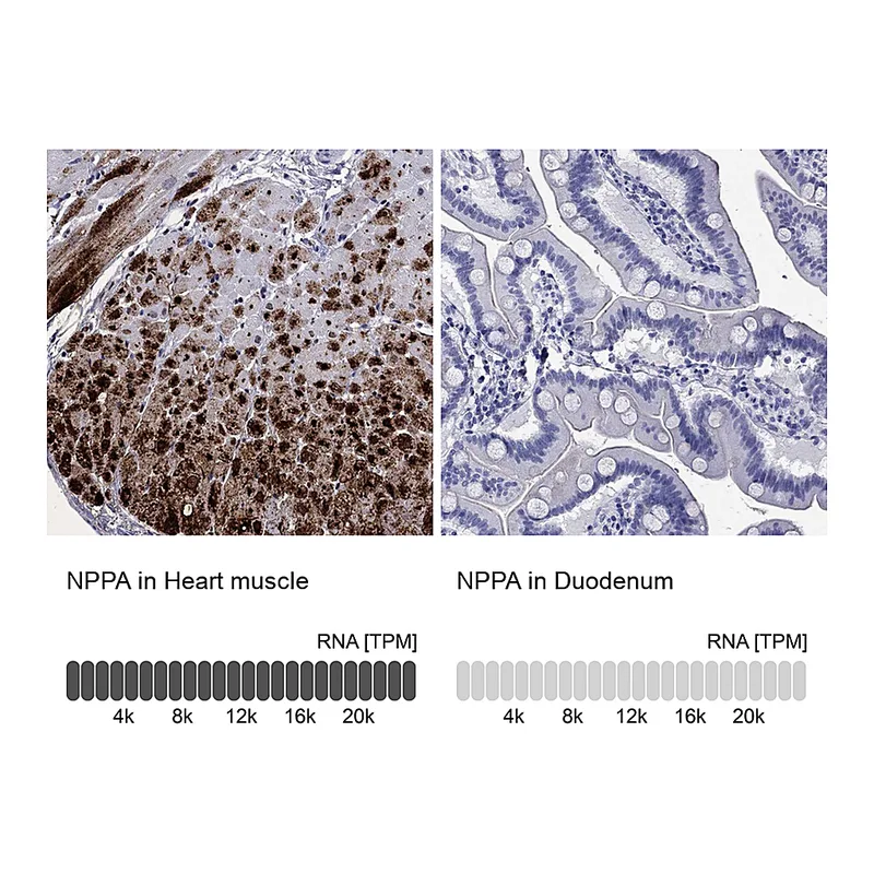 Atlas Antibodies Anti-NPPA Antibody