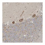 Atlas Antibodies Anti-NPPC Antibody