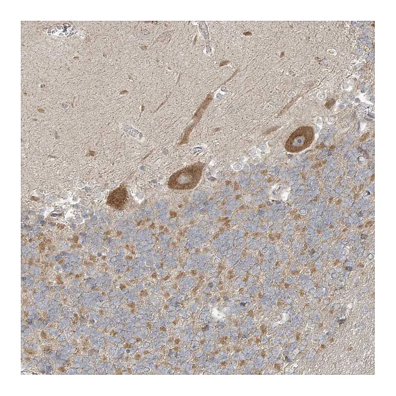 Atlas Antibodies Anti-NPPC Antibody