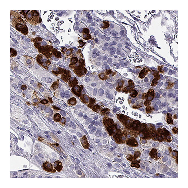Atlas Antibodies Anti-NPTX2 Antibody
