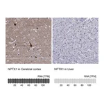 Atlas Antibodies Anti-NPTX1 Antibody