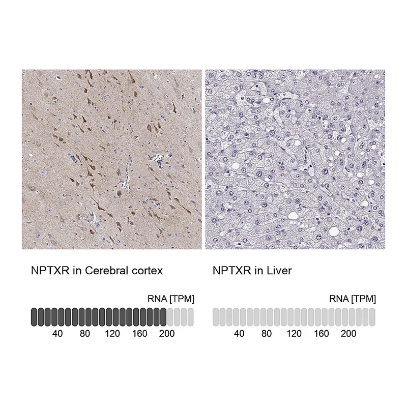 Atlas Antibodies Anti-NPTXR Antibody