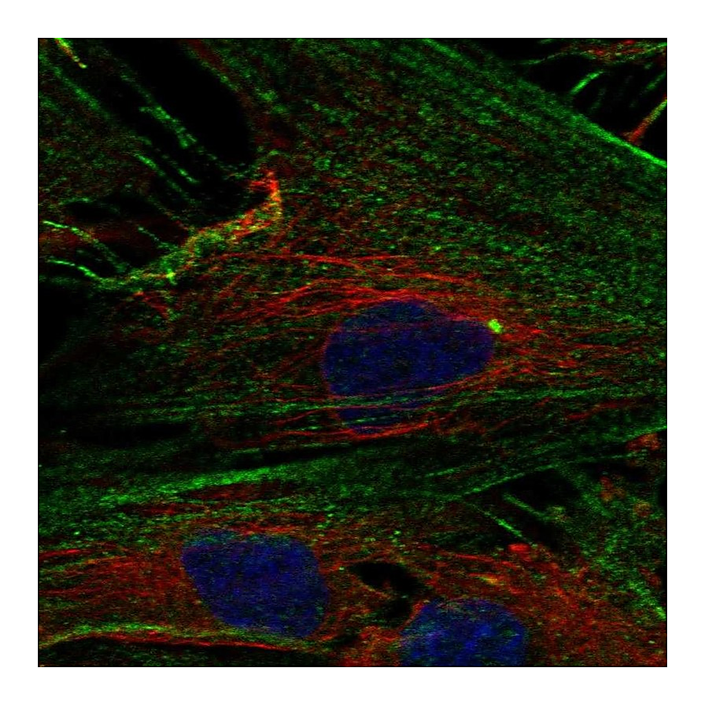 Atlas Antibodies Anti-NPTX2 Antibody