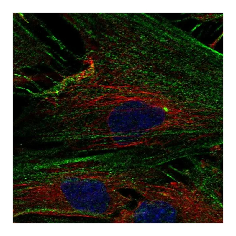 Atlas Antibodies Anti-NPTX2 Antibody