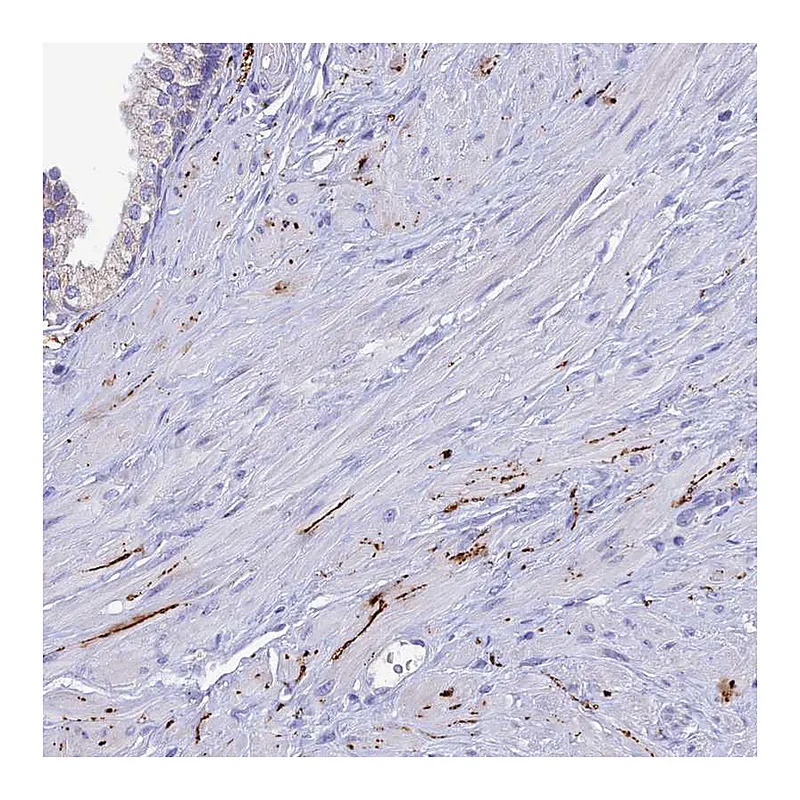 Atlas Antibodies Anti-NPY Antibody