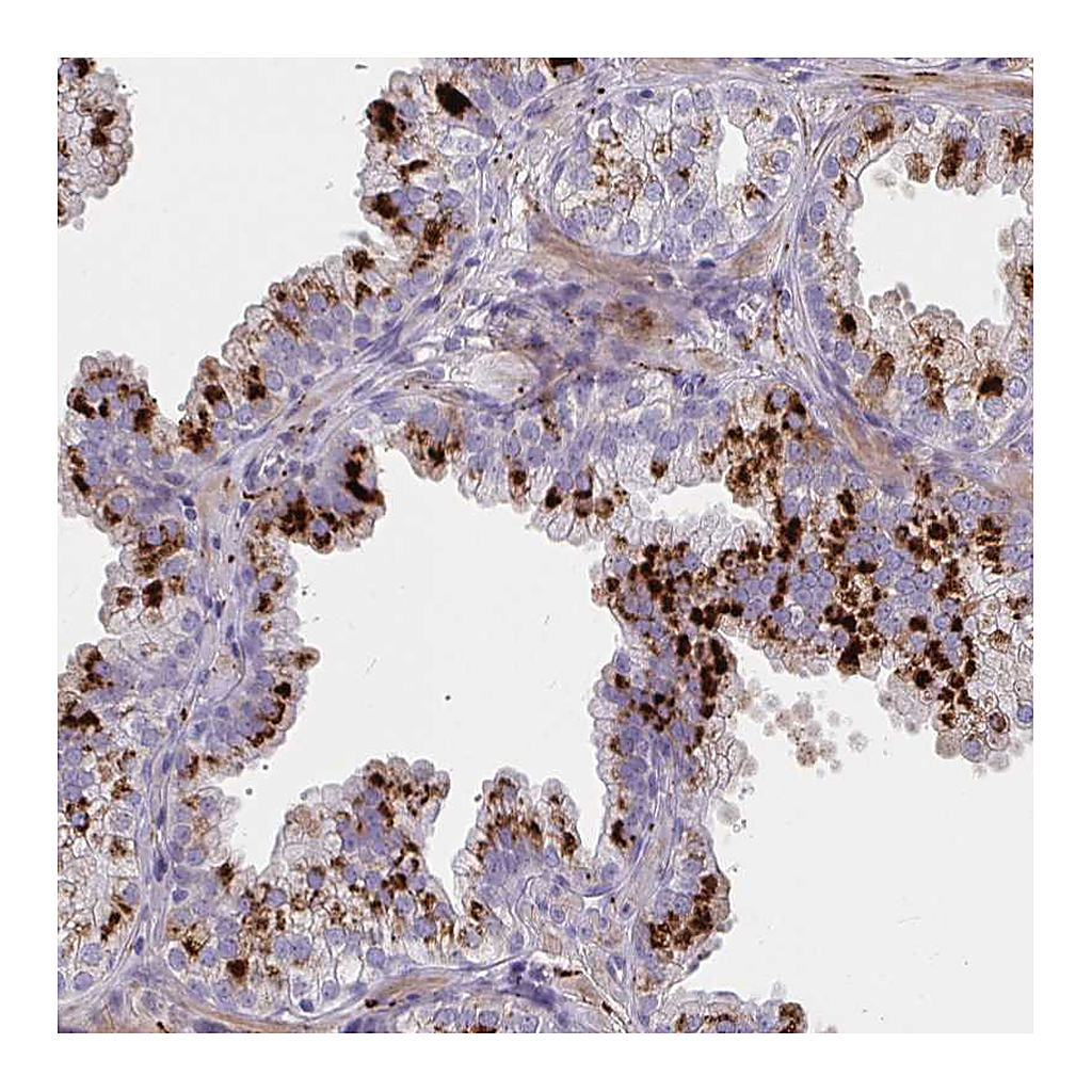 Atlas Antibodies Anti-NPY Antibody