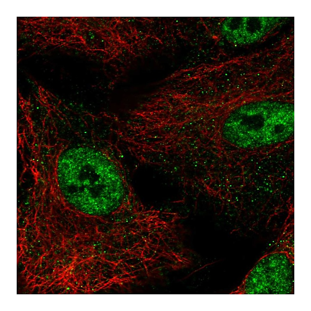 Atlas Antibodies Anti-NR0B1 Antibody