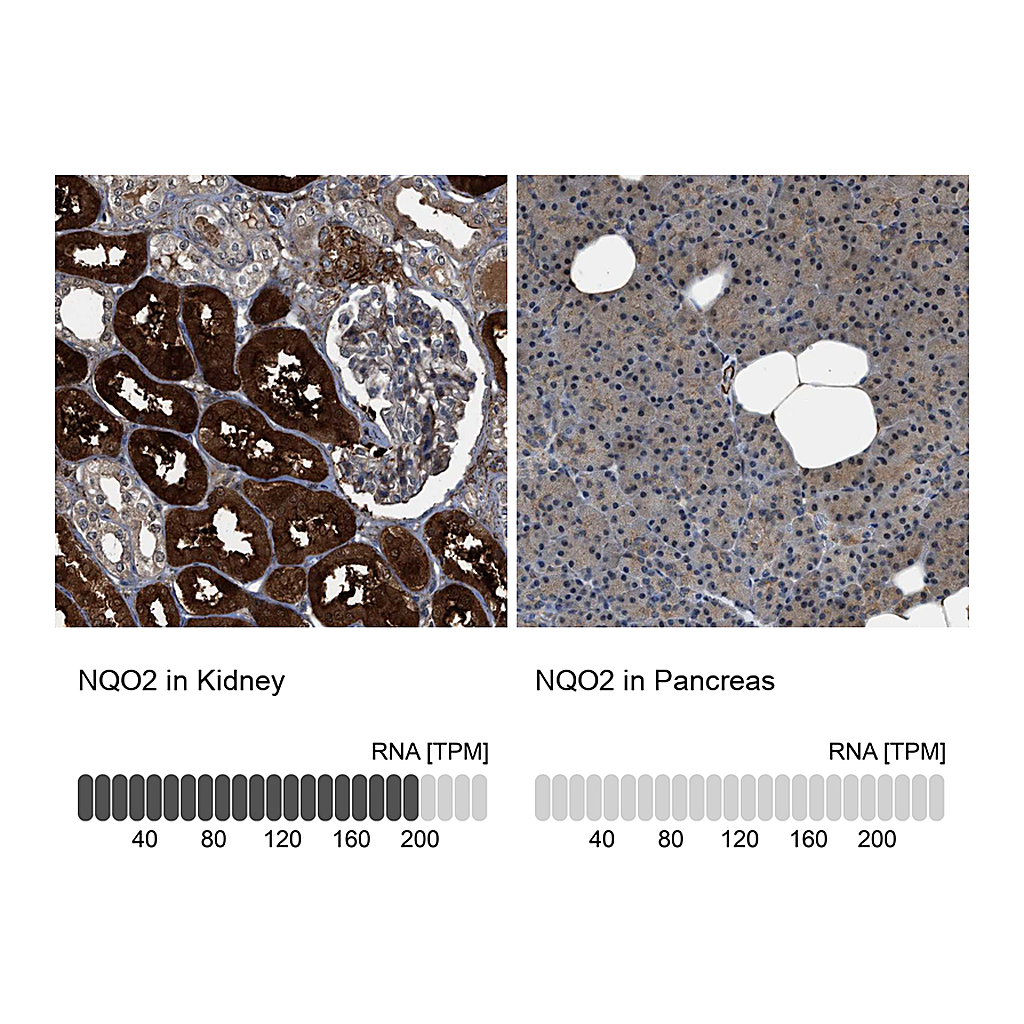 Atlas Antibodies Anti-NQO2 Antibody