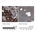 Atlas Antibodies Anti-NQO2 Antibody