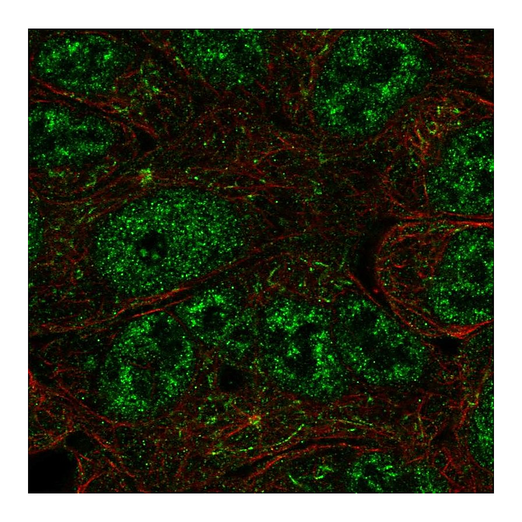 Atlas Antibodies Anti-NR0B1 Antibody