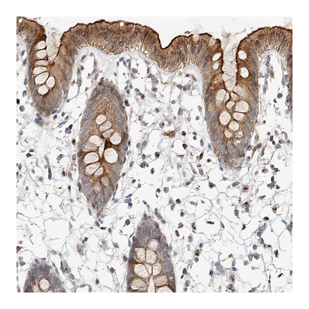 Atlas Antibodies Anti-NPY4R Antibody