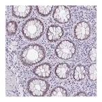 Atlas Antibodies Anti-NR1D2 Antibody