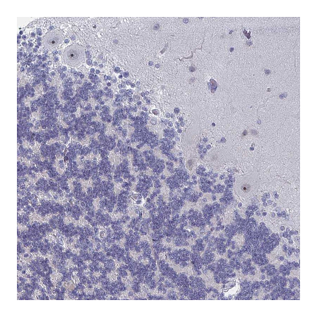 Atlas Antibodies Anti-NR1H2 Antibody