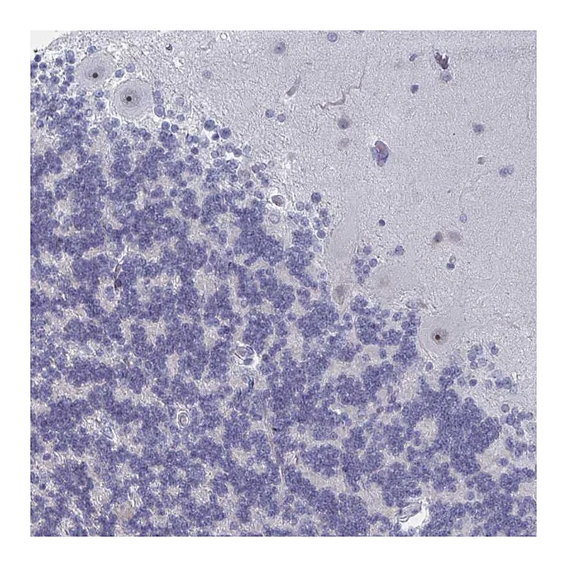 Atlas Antibodies Anti-NR1H2 Antibody