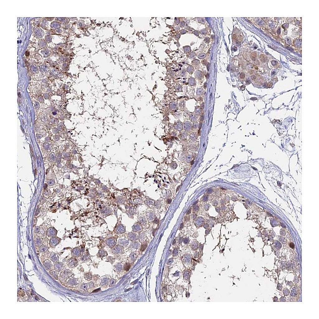 Atlas Antibodies Anti-NR1H3 Antibody