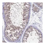 Atlas Antibodies Anti-NR1H3 Antibody