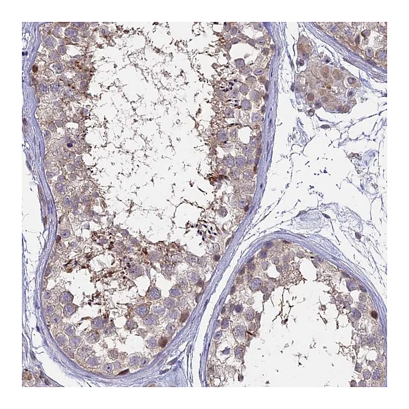 Atlas Antibodies Anti-NR1H3 Antibody