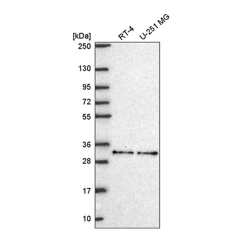 Atlas Antibodies Anti-NR1H2 Antibody