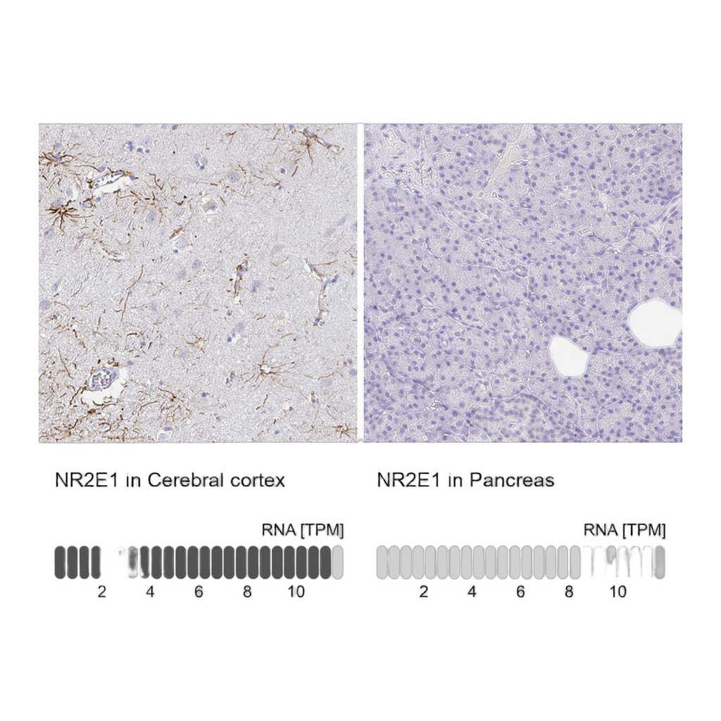 Atlas Antibodies Anti-NR2E1 Antibody
