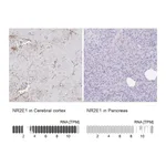 Atlas Antibodies Anti-NR2E1 Antibody
