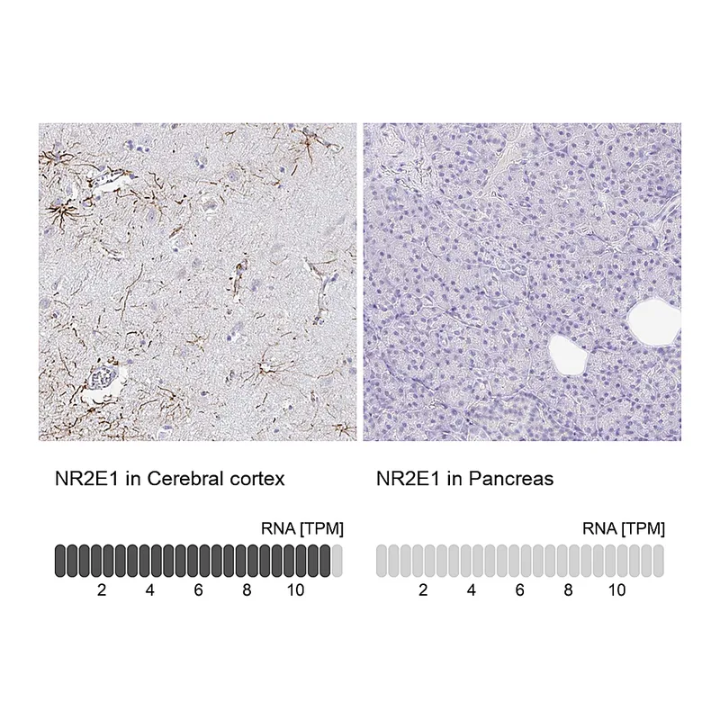 Atlas Antibodies Anti-NR2E1 Antibody
