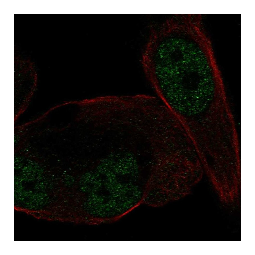 Atlas Antibodies Anti-NR3C2 Antibody