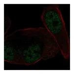 Atlas Antibodies Anti-NR3C2 Antibody