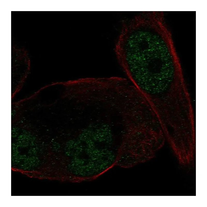 Atlas Antibodies Anti-NR3C2 Antibody