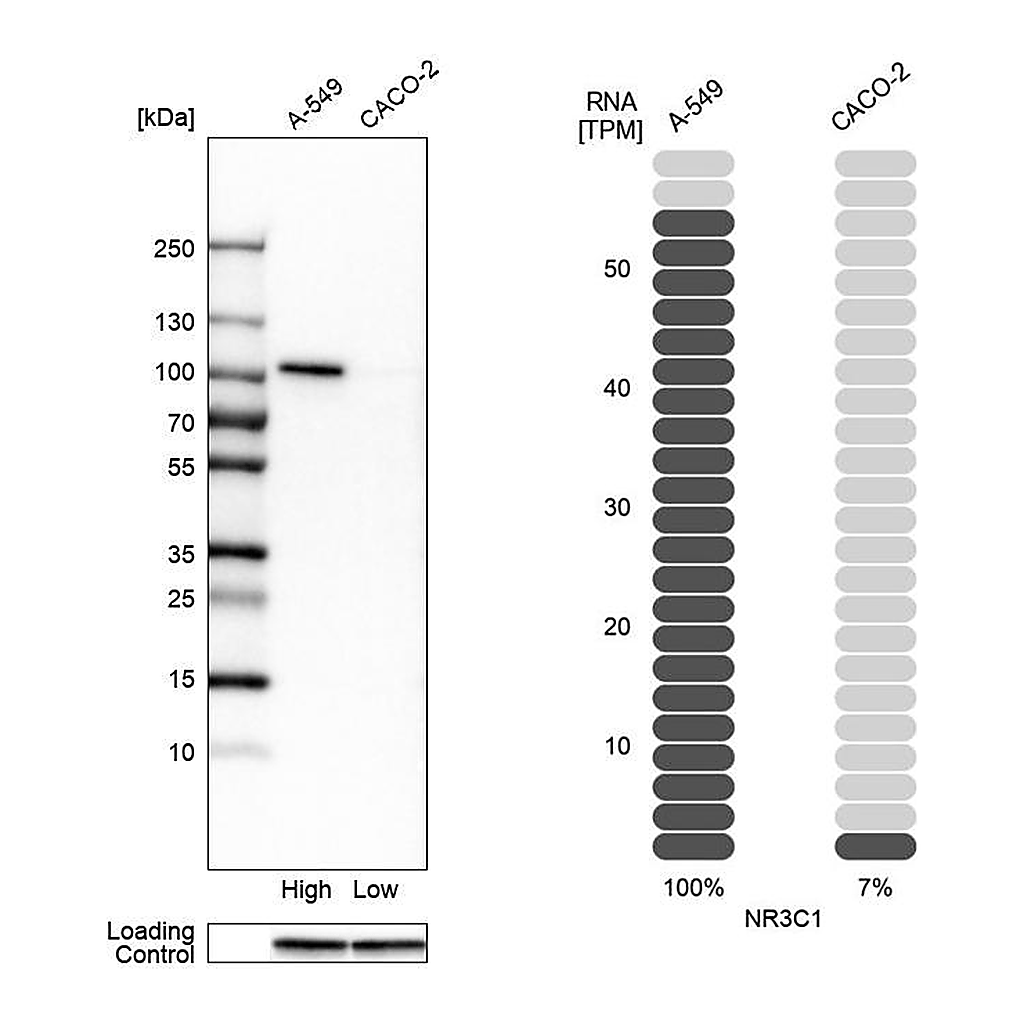 Atlas Antibodies Anti-NR3C1 Antibody
