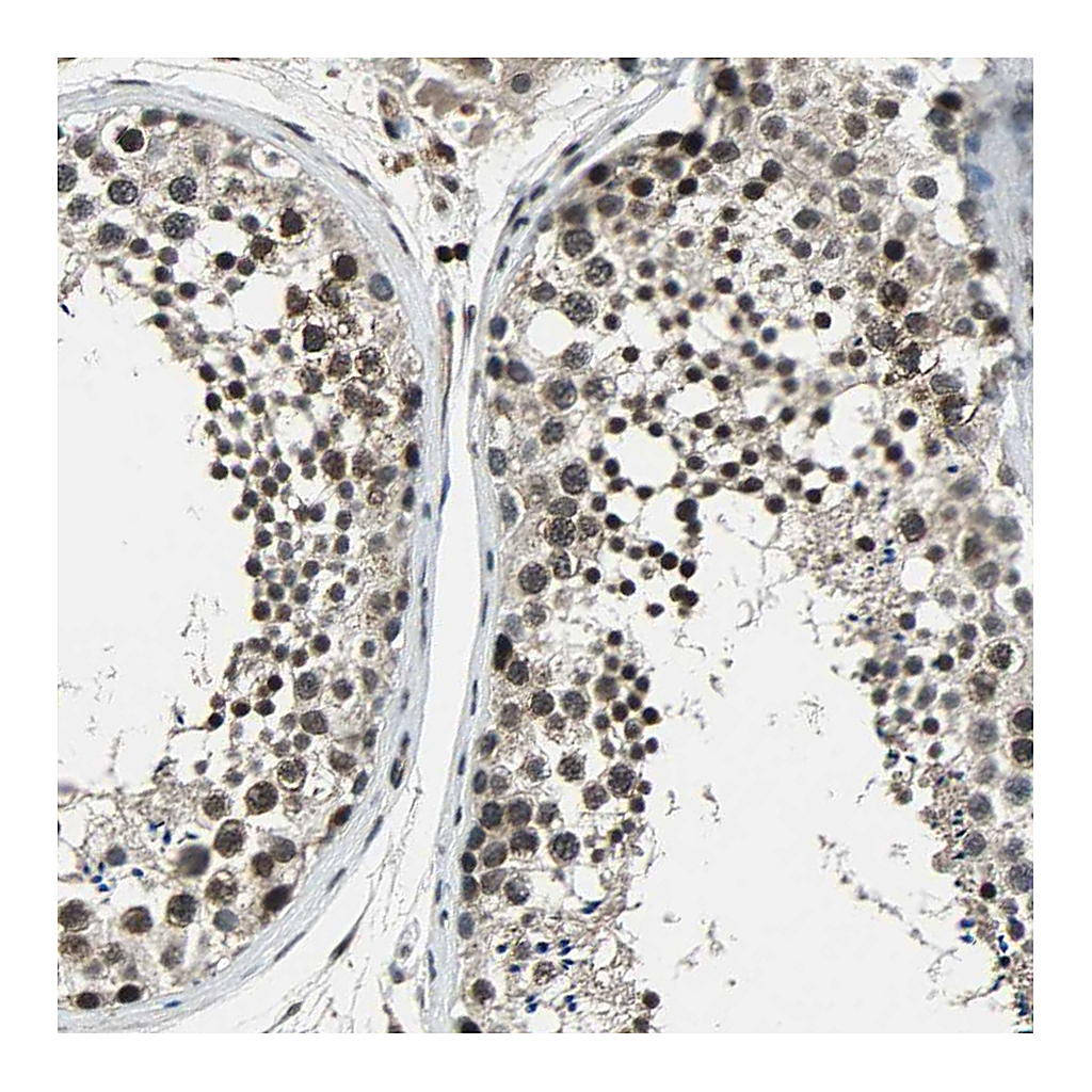 Atlas Antibodies Anti-NR2C2 Antibody