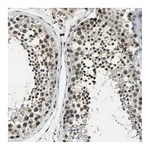 Atlas Antibodies Anti-NR2C2 Antibody