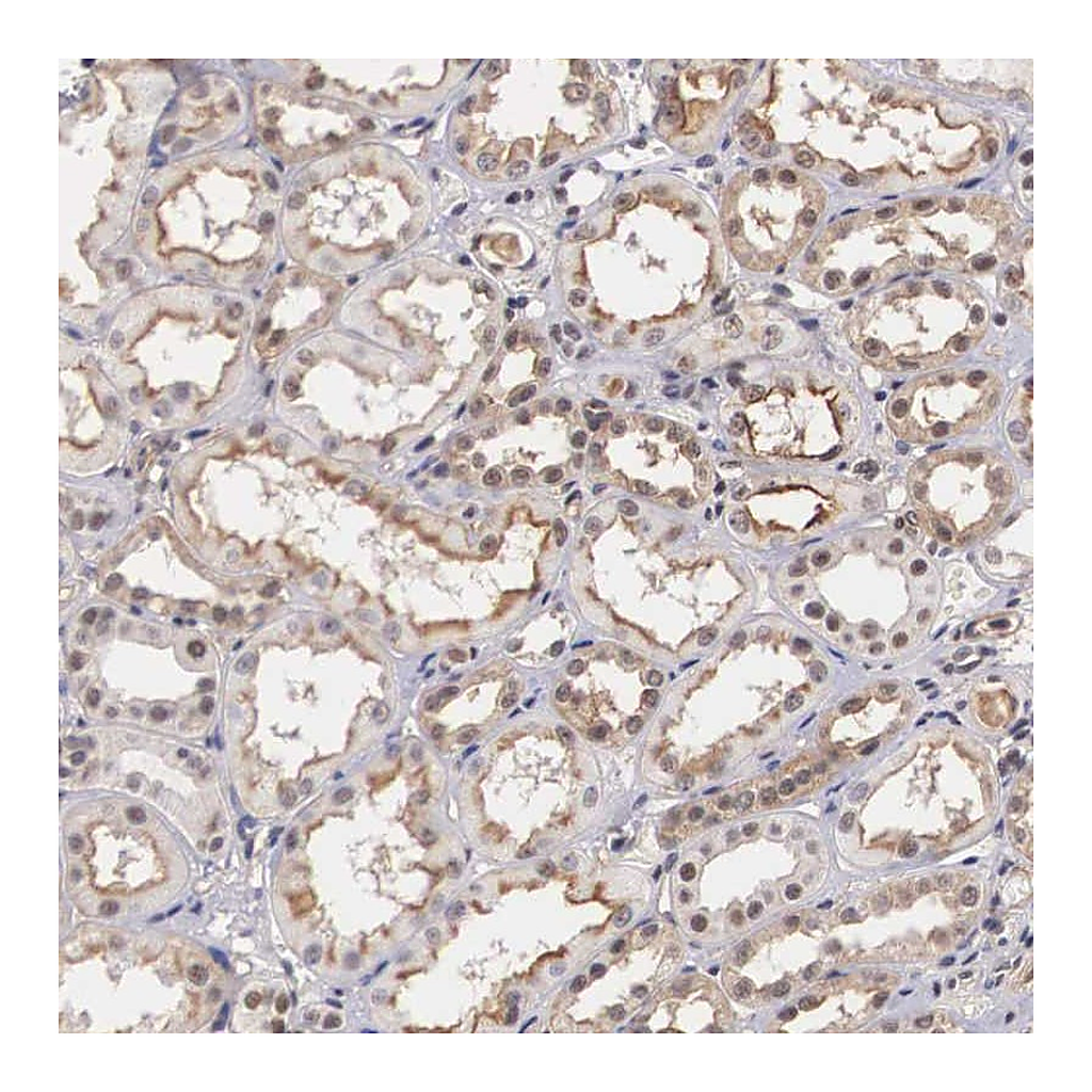 Atlas Antibodies Anti-NR4A2 Antibody