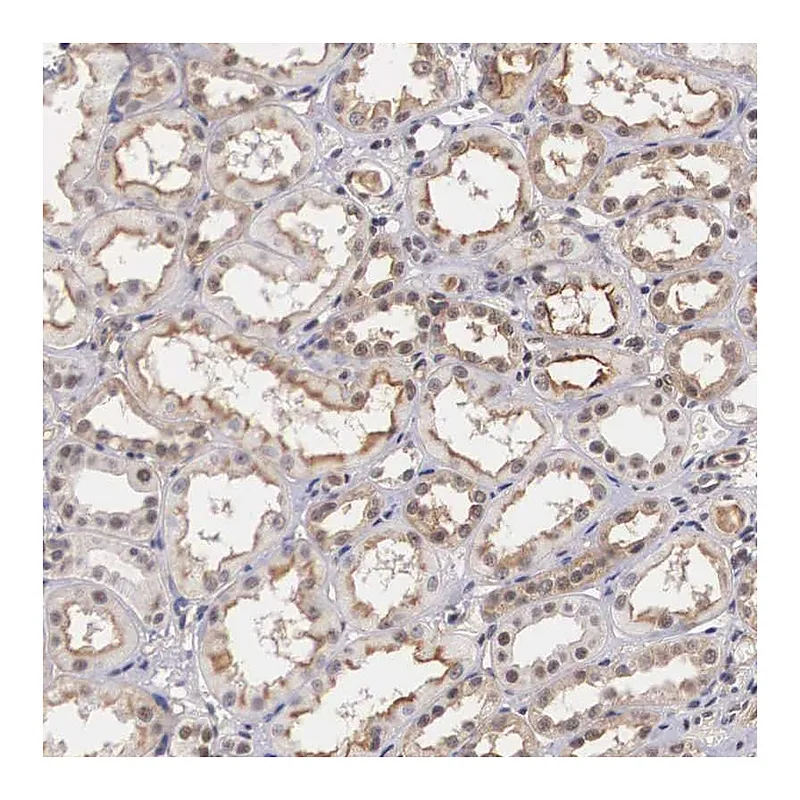 Atlas Antibodies Anti-NR4A2 Antibody