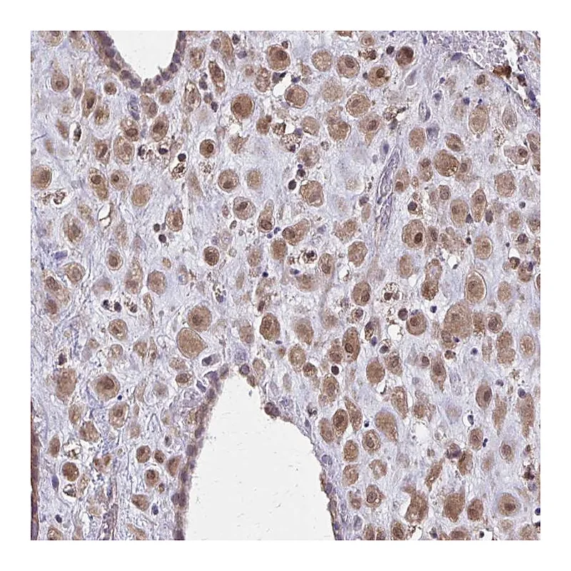 Atlas Antibodies Anti-NRBF2 Antibody