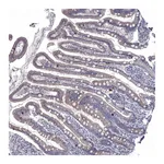 Atlas Antibodies Anti-NRARP Antibody