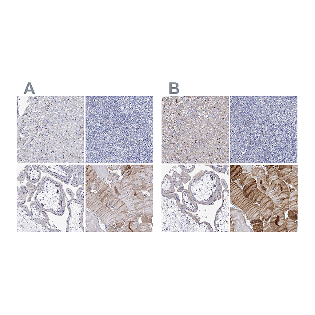 Atlas Antibodies Anti-NRAP Antibody