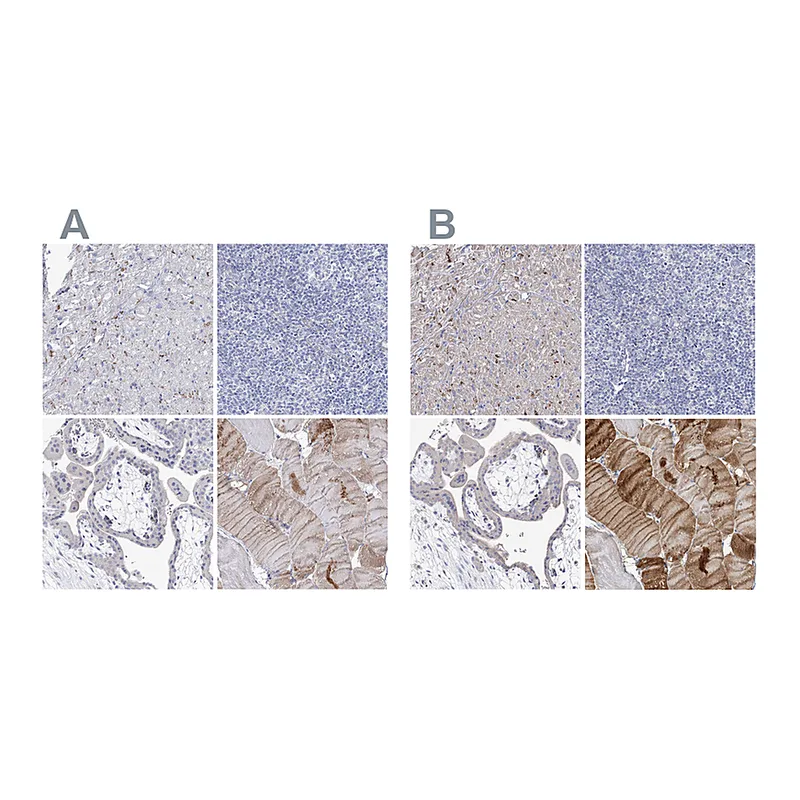 Atlas Antibodies Anti-NRAP Antibody