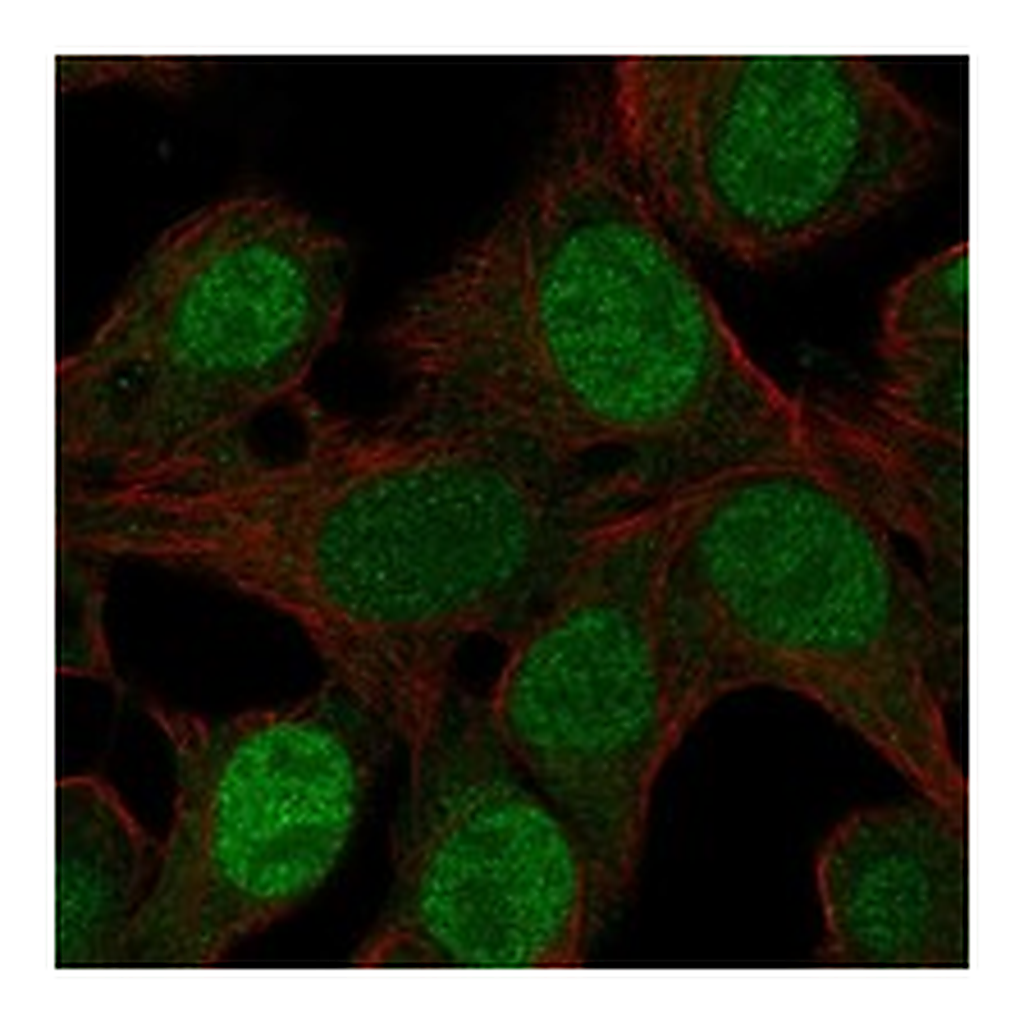 Atlas Antibodies Anti-NR5A1 Antibody